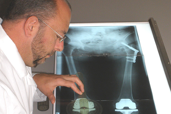 Doctor reviewing X-ray